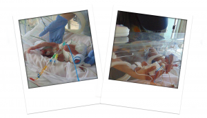 preemie baby in incubator Glasgow QEUH NICU