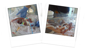 preemie baby in incubator