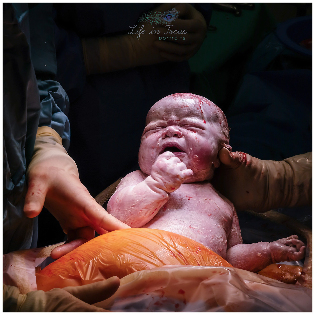 caesarian section delivery Life in Focus Portraits birth photography Rhu Argyll and Bute