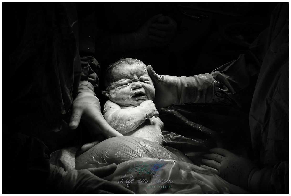 new baby being delivered via gentle c-section Life in Focus Portraits birth photographer Helensburgh Dumbarton